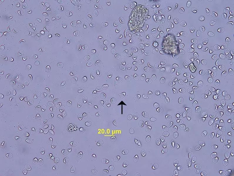 幼犬梨形鞭毛虫病的诊断