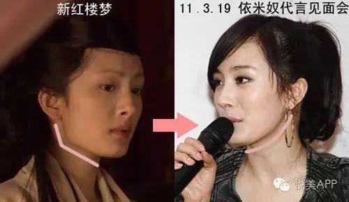 杨幂以前的水桶型脸可以演上神吗?论下颌角位置的重要性.