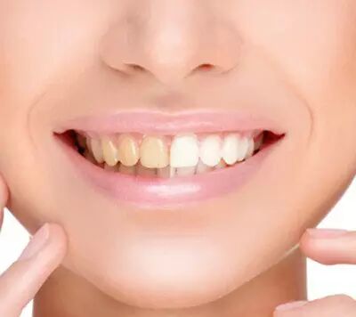 请收下这份美丽制胜的神器，才配得上你的口红