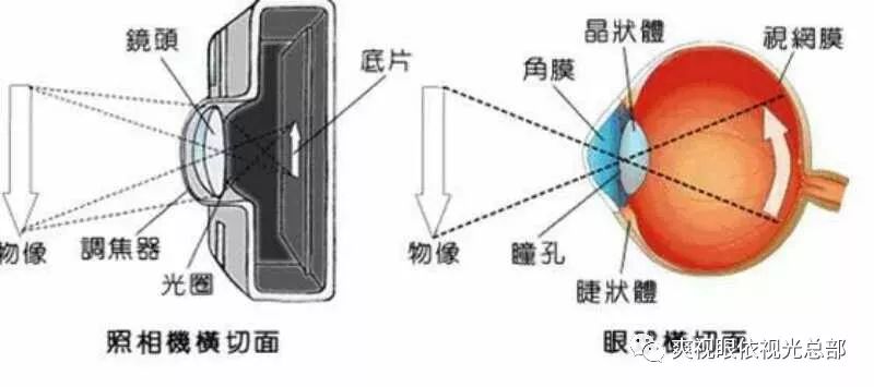 眼依吴主任:眼睛和照相机(卡片机)成像原理