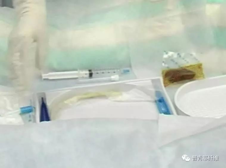 Ⅴ 女患者导尿术·二次消毒 ①按照操作顺序排列导尿包内用物,常规