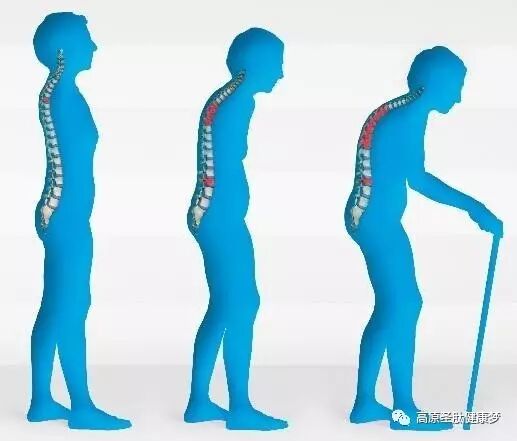 牦牛骨胶原肽能快速被人体吸收 有效改善骨质疏松 骨关节炎 骨质增生 骨刺 关节软骨退化 风湿等多种骨关节病变 高原圣肽健康梦