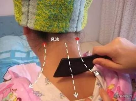 刮痧为什么能去斑、去痘、美容？这些是你不知道