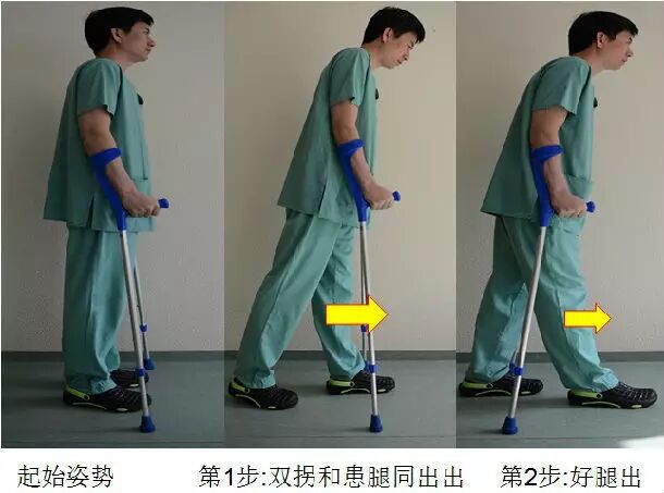 肘拐怎么用【康复助手】您知道肘拐吗？_https://www.jmylbn.com_新闻资讯_第6张