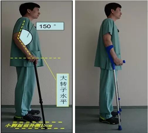 肘拐怎么用【康复助手】您知道肘拐吗？_https://www.jmylbn.com_新闻资讯_第3张