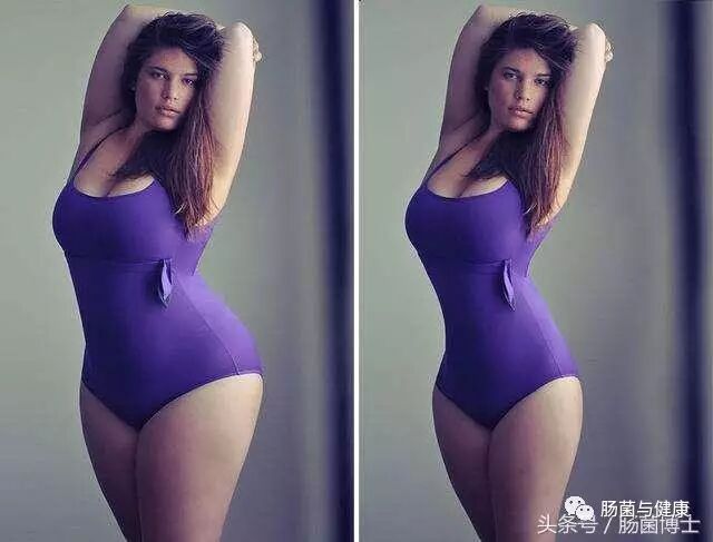 减肥手术后遗症_减肥手术有什么危害_手术减肥