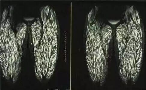 满脑子寄生虫源于贪恋生食