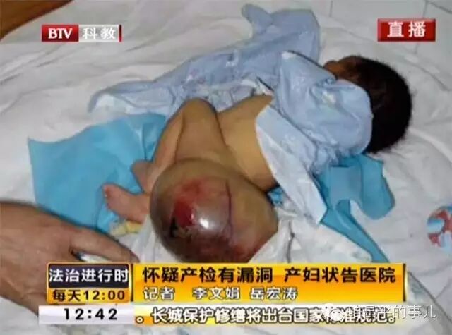 昌平妇幼保健院 怀孕39周得知孩子有问题 产妇怀疑产检有漏洞状告医院-怀孕期