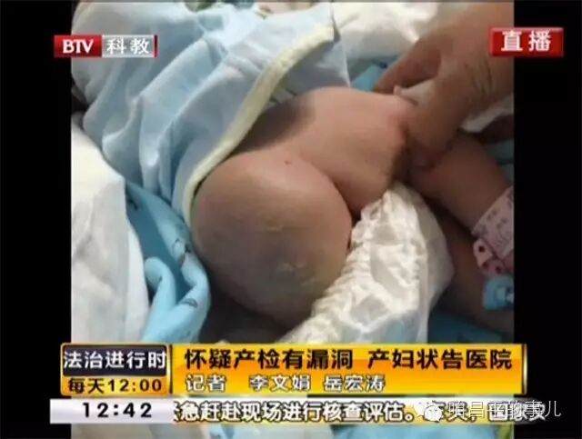 昌平妇幼保健院 怀孕39周得知孩子有问题 产妇怀疑产检有漏洞状告医院-怀孕期