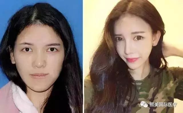 昆凌、李嘉欣那样的混血脸,靠整容能达到吗?