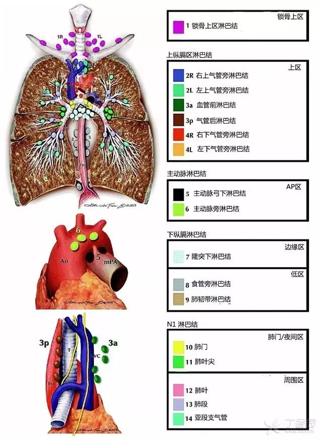 一文搞懂 | 纵膈及肺部淋巴结分区解读(肺癌)