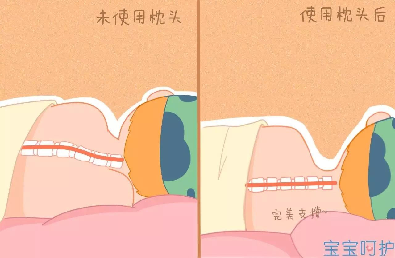 这样给宝宝枕枕头,难怪他夜间爱哭闹 宝贝呵护文章