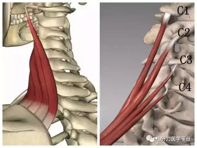 【针刀篇】肩胛提肌的解剖与针刀定位