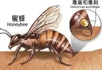 同样被蜜蜂蛰后,一死一生,医生呼吁转发