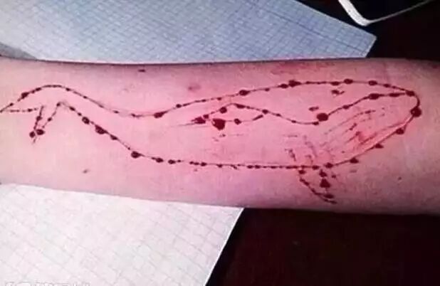 警惕让孩子自残、自杀的“蓝鲸游戏”