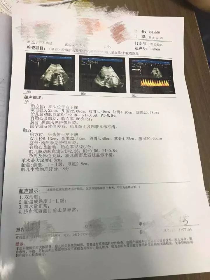 她怀孕2次 和父母撕破脸 妈宝男友竟与别人闪婚 拿20万要她打掉双胞胎