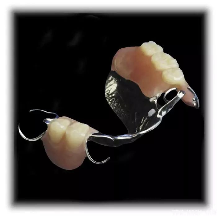 研究者基于患者三维影像数据,对上颌局部, 牙齿和修复体进行有限元