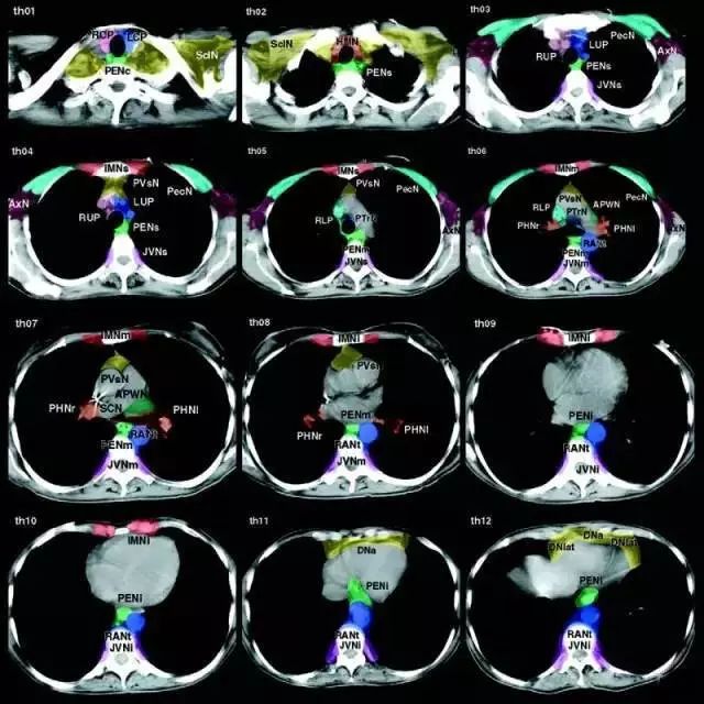 【临床美图】全身各区域淋巴结 ct 图谱!