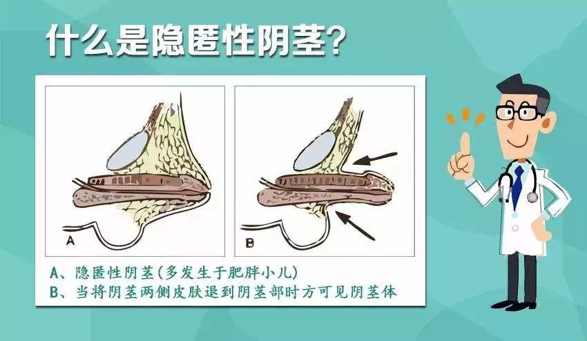 鳌拜的"缩阳入腹"能实现吗?竟然还有神秘老太喜欢收藏丁丁?