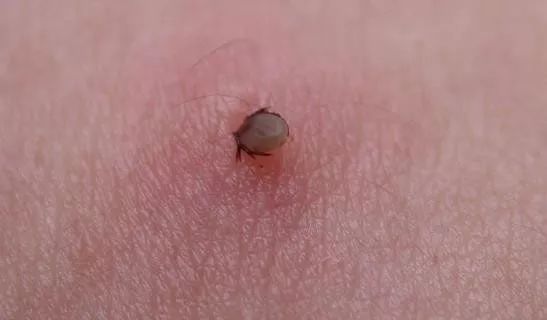 正在吸血的蜱虫