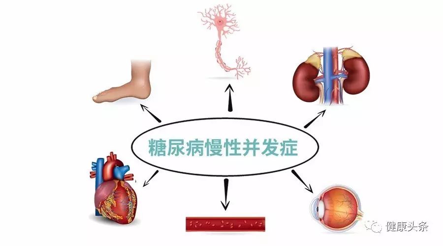 糖尿病慢性并发症可危及全身