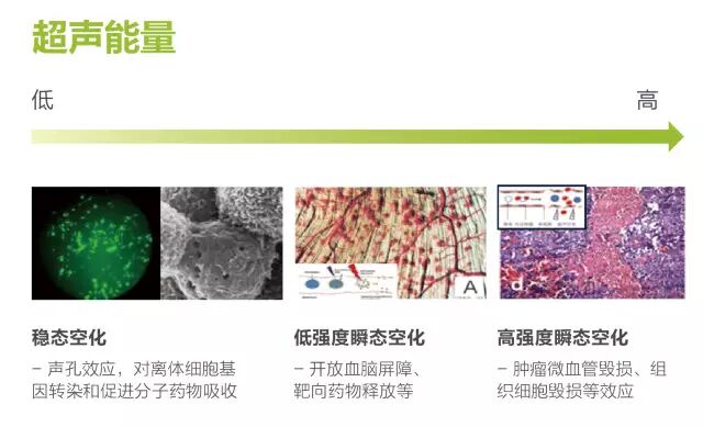 vinno是什么超声颠覆性的超声空化治疗技术 ｜ VINNO70 超声诊疗一体机-上海聚慕医疗器械有限公司