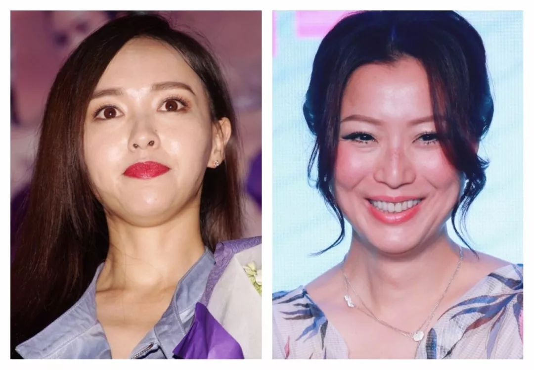 法令纹双下巴脸垮……想推荐郑爽和唐嫣用这件神器