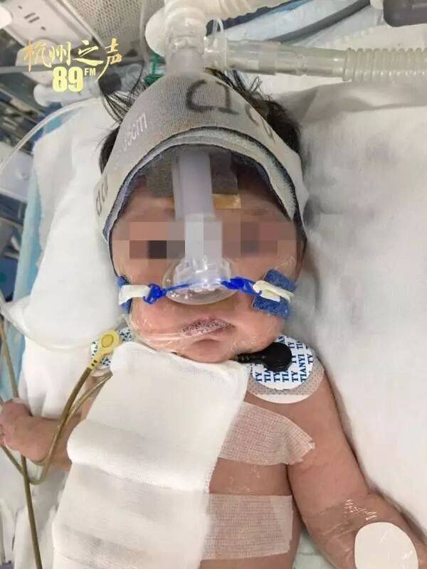 惊险!二胎女宝只长半个心脏,浙大儿院的这场手术,让所有人都揪心!-怀孕期