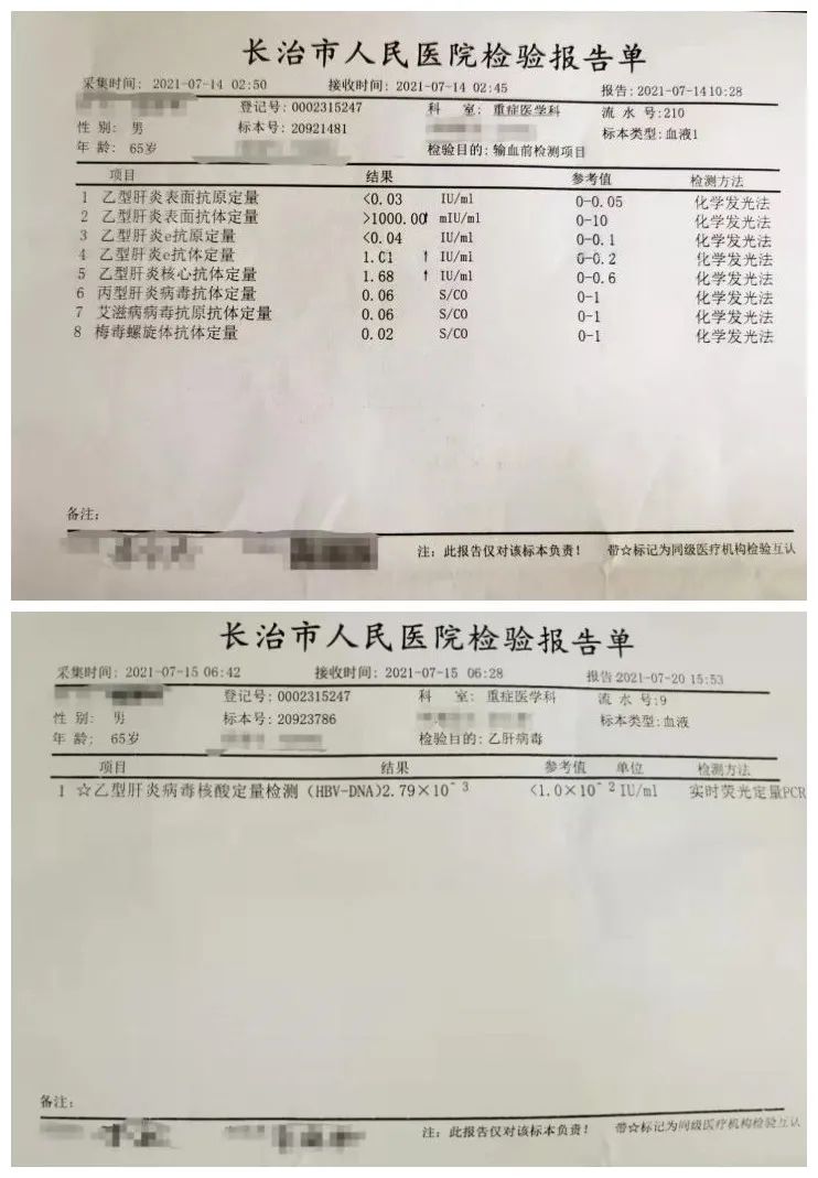 肝脏.2002[12][3]隐匿性乙型肝炎患者肝组织中hbv标志物的表达.