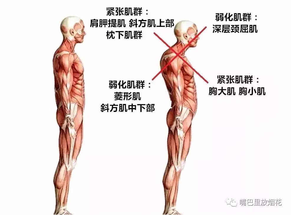 上交叉综合症(ucs)的干预