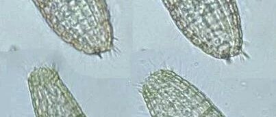 裸口目之板壳虫属 微生物镜检 微信公众号文章阅读 Wemp