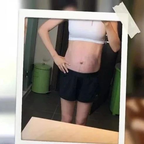 谢楠晒9个月孕肚,表示二胎要顺产,尽然有马甲线,网友被她发紫的肚子吓到了?!