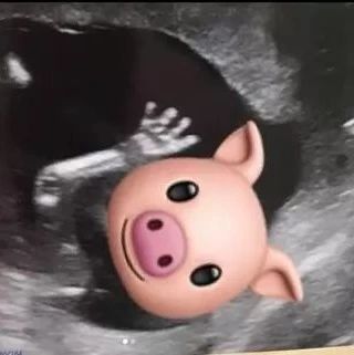 39岁胡杏儿宣布怀二胎!激动晒b超图:猪宝宝终于加入