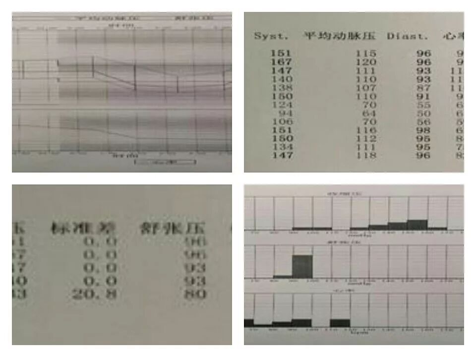 welchallyn是什么Wow!长安社卫中心新引进的医疗设备——美国WelchAllyn动态血压监测仪!_https://www.jmylbn.com_新闻资讯_第3张