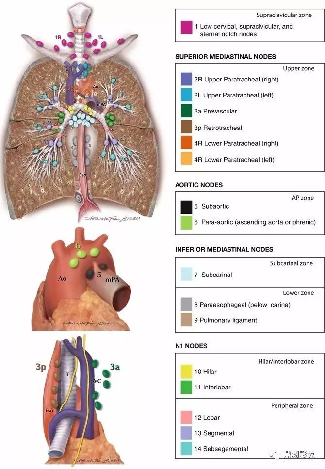 一文搞懂 | 纵膈及肺部淋巴结分区解读(肺癌)