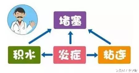 心酸!右侧输卵管粘连,备孕一年半仍然不孕,我接下来该怎么办?