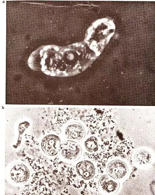 显微镜下的阿米巴原虫