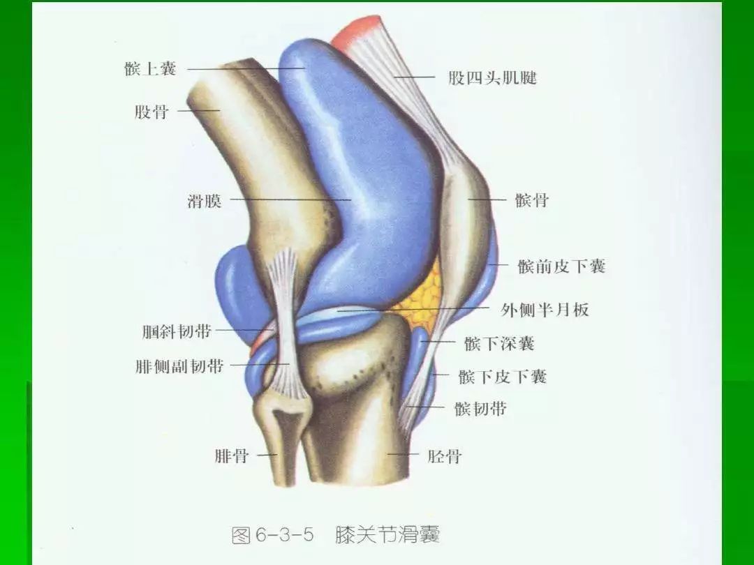 支持带处有压痛(被撕毁);  常见绷紧的渗出液(关节血肿);  阳性的髌骨