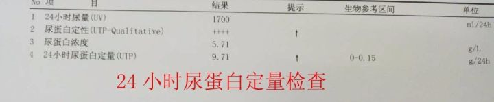 关于尿蛋白定量检测,你想知道的都在这里