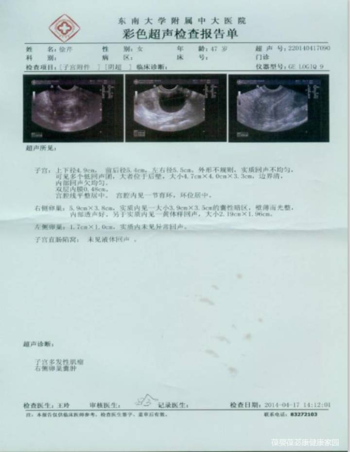 妇科子宫肌瘤暖巢囊肿人乳头瘤hpv月经问题宫颈糜烂葆苾康调理案例