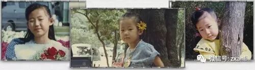 发际线种植效果怎么样？来看看我的真实经历吧