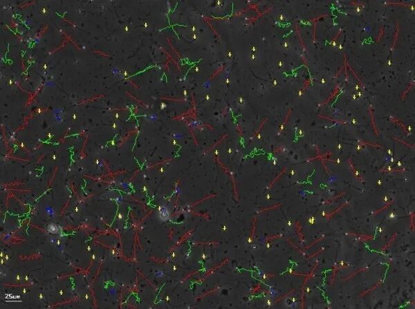 【好孕之声】计算机辅助精子分析及初次精液检查攻略