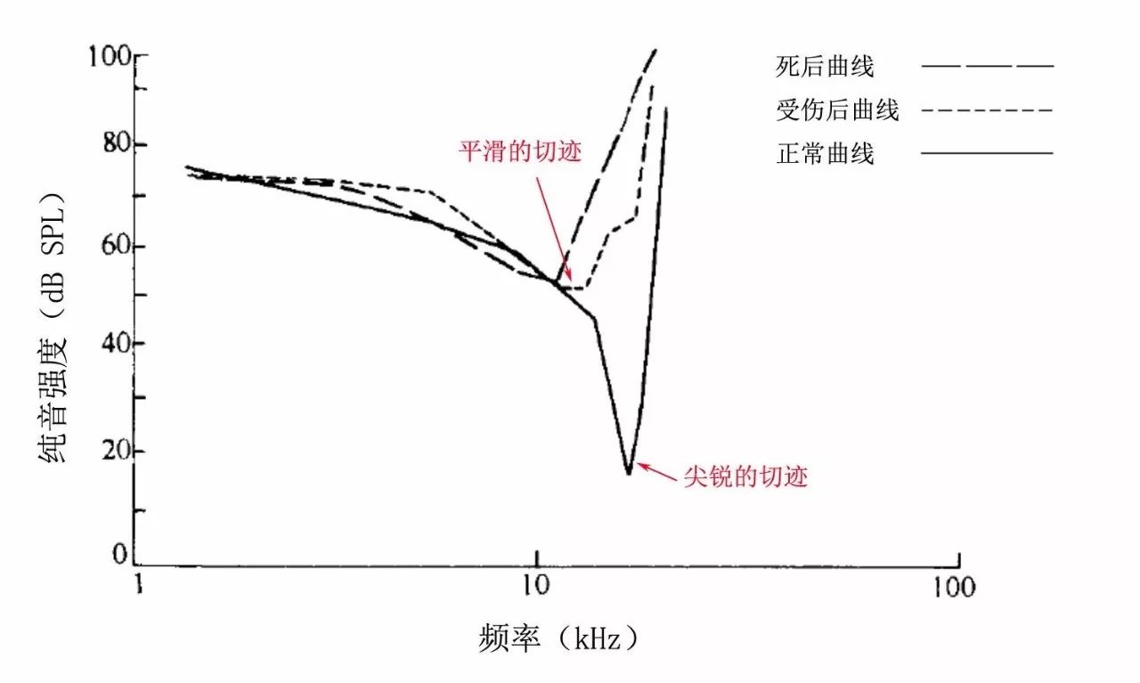 客观测听 | 耳声发射