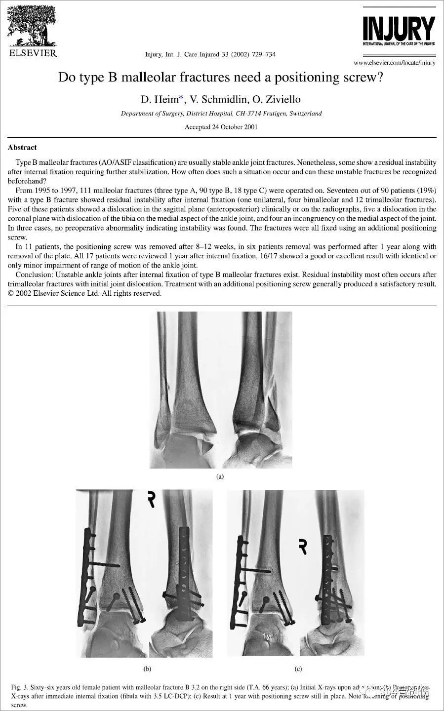 固定后行踝关节应力外旋试验,若透视下踝穴位x线片胫腓间隙较前增宽>3