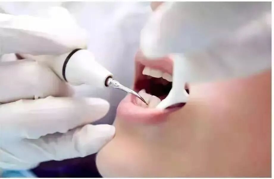 怎么选洁牙器械【诺美口腔·4店适用】49.9元享洁牙套餐：口腔健康档案、全口口腔问题诊断、无菌治疗器械、成人超声波洁牙...._https://www.jmylbn.com_新闻资讯_第26张