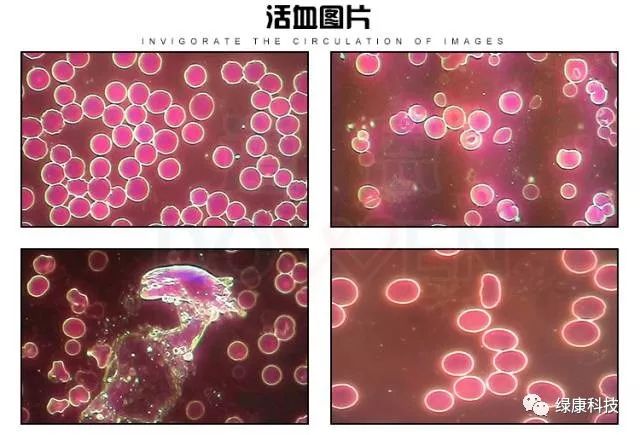 一滴血检测仪的活血分析是利用暗视野及相差显微技术确定血液