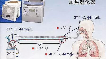 为什么要用湿化器不可忽略的气道湿化_https://www.jmylbn.com_新闻资讯_第4张