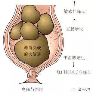 肛门,直肠疾病