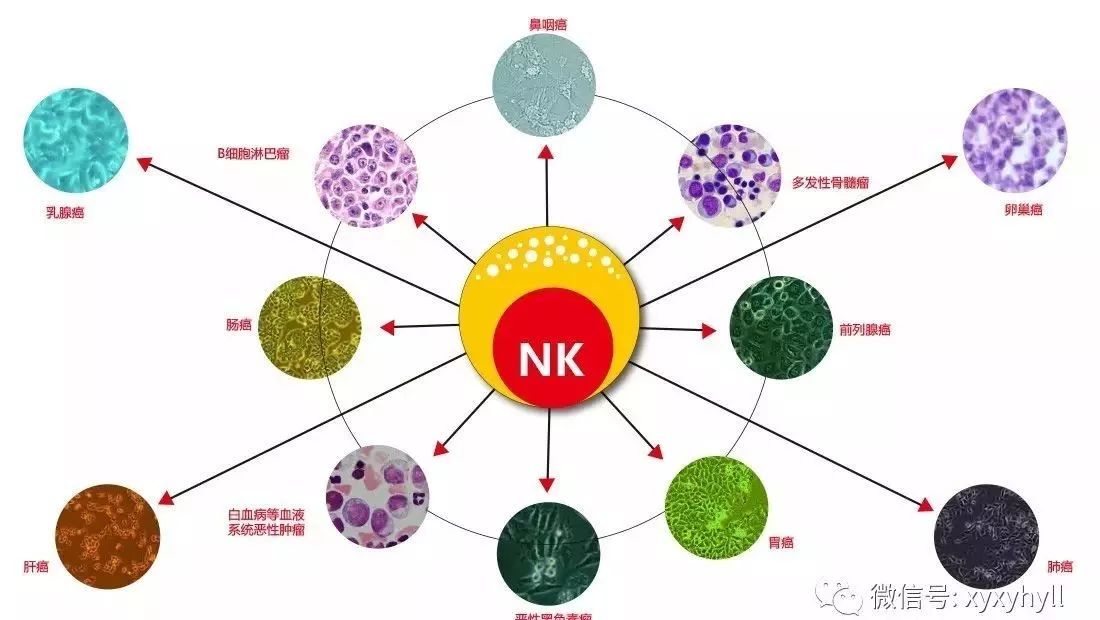 NK治疗对策全汇总