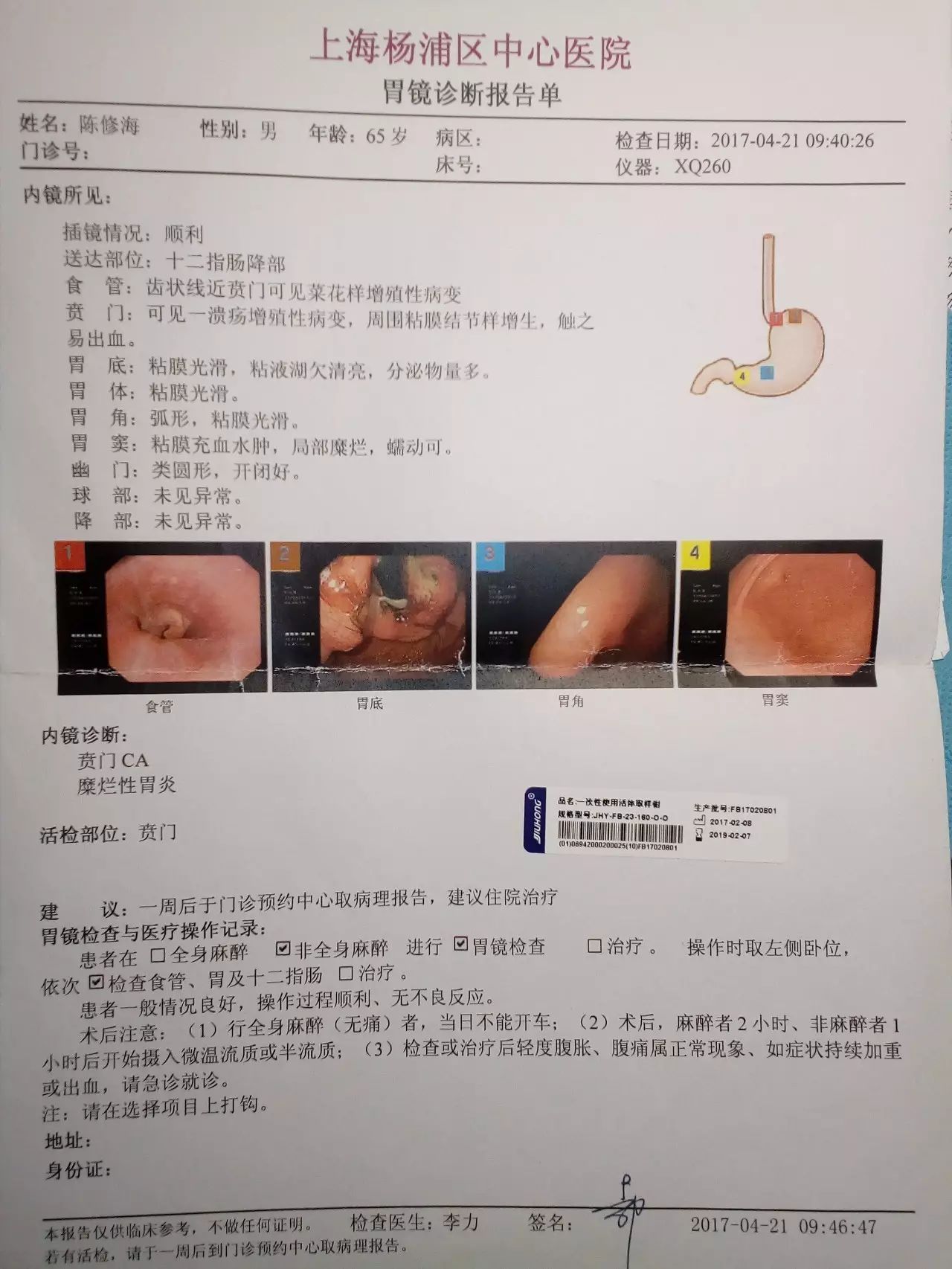a,上海杨浦区中心医院胃镜报告单